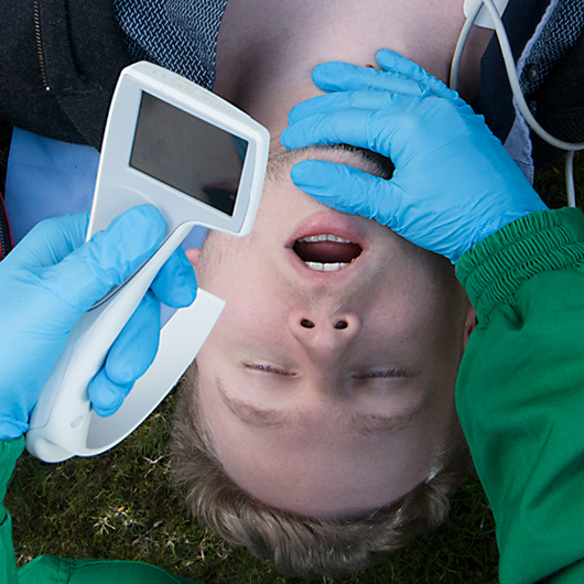 Laringoscopia de vídeo universal (UVL)