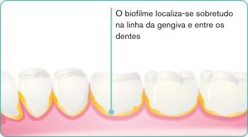 PT-explore-image-oral-care-vap-facts-2.jpg