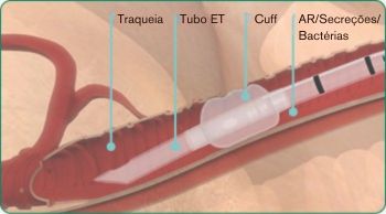 PT-explore-image-oral-care-vap-facts-3.jpg